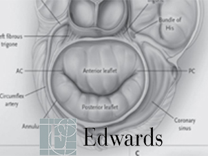 Mitral valve